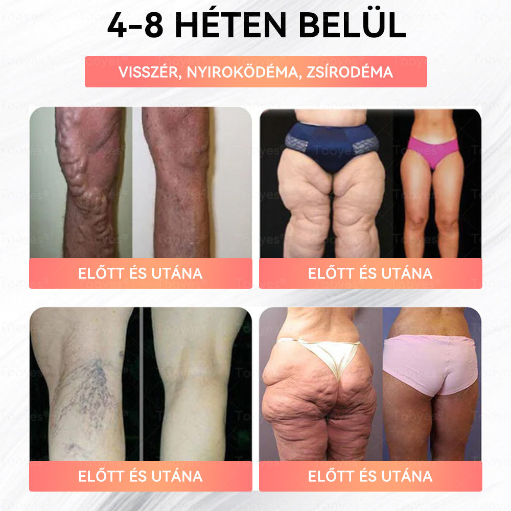 Tooyes® GLP-1 Magas Koncentrációjú Folyékony Gyöngyök - NAD+, Moringa, HCA összetevőkkel (Fogyás, Öregedésgátlás, Bél- és Immunrendszer támogatás, Vércukorszint egyensúly, Szív- és Agyegészség)