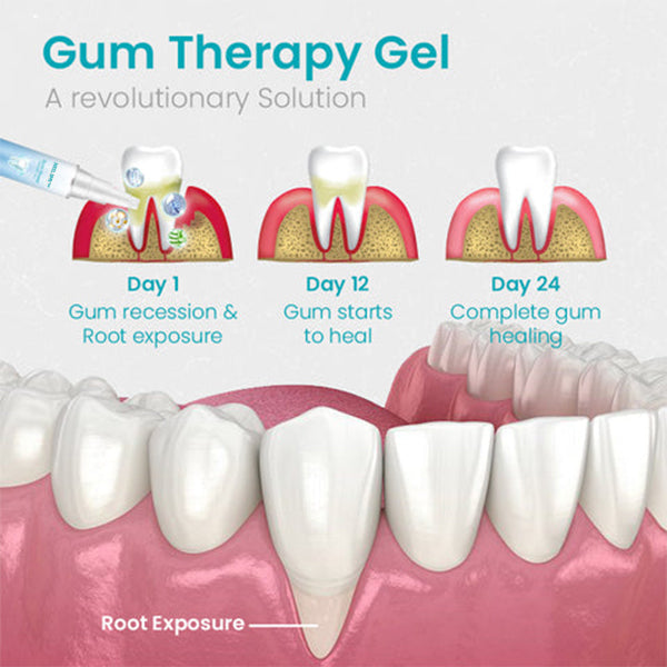 đ„Last Day Promotion 80% OFF-NESLEMYâą Gum Shield Therapy Gel