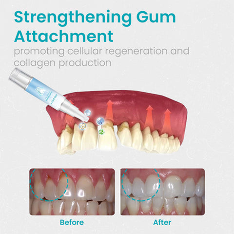 đ„Last Day Promotion 80% OFF-NESLEMYâą Gum Shield Therapy Gel