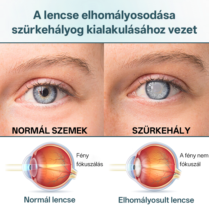 ✅Timilke® optiFusion Nanoszemcsepp szérum⭐⭐