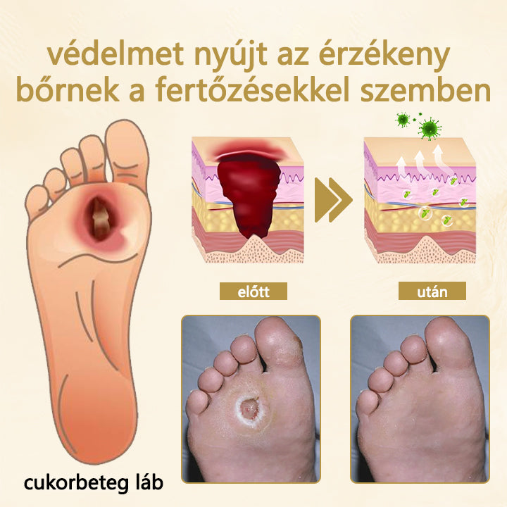 🌿🐝Cvreoz® méhméreg gyógyítóspray a sebek gyógyulására és regenerálására a kezeken és alábakon
