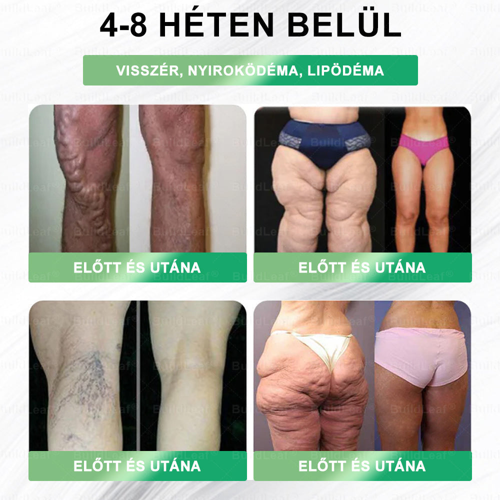 BuildLeafe® GLP-1 8-in-1 Fit & Vital Szájhigiéniai oldat Alkalmas elhízás, szív- és érrendszeri egészség, cukorbetegség, alvási apnoe, bélrendszeri egészség, ízületiproblémák és egyéb egészségügyi igények esetén