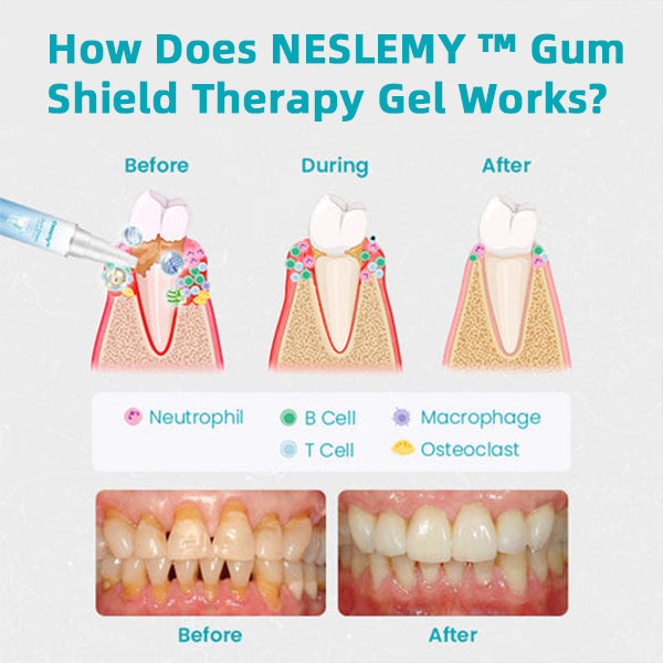 đ„Last Day Promotion 80% OFF-NESLEMYâą Gum Shield Therapy Gel