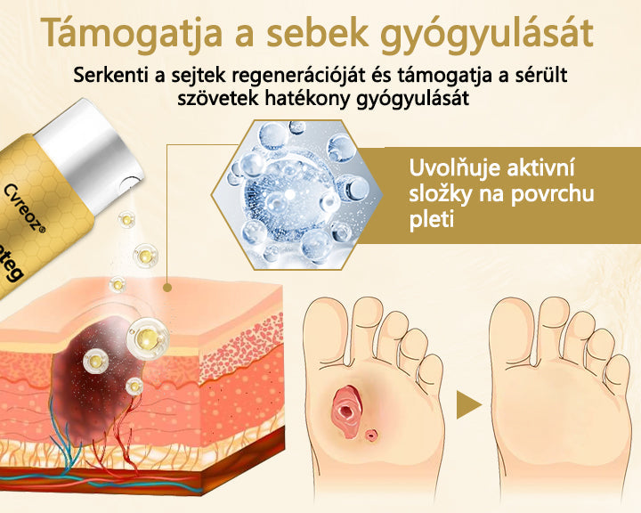 🌿🐝Cvreoz® méhméreg gyógyítóspray a sebek gyógyulására és regenerálására a kezeken és alábakon