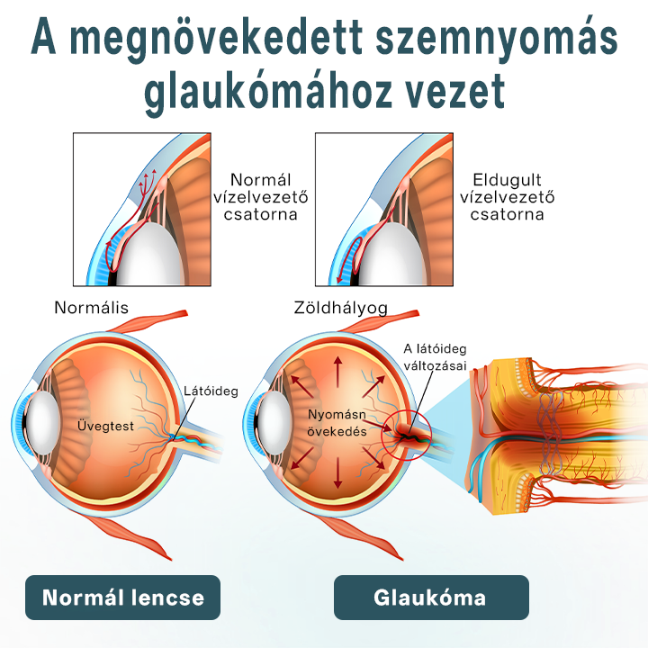✅Timilke® optiFusion Nanoszemcsepp szérum⭐⭐