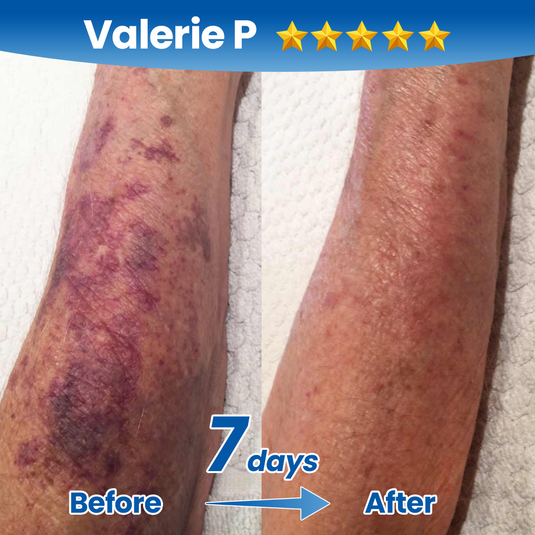Timilk Fragile Skin Repair
