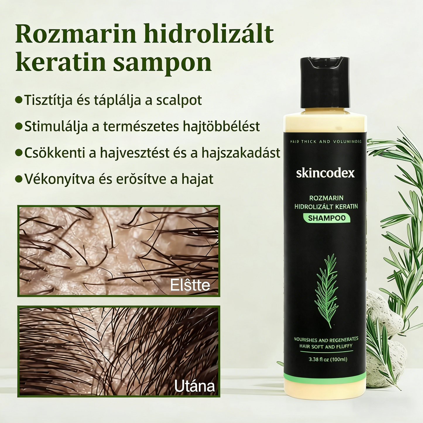 🔥UTÓS NAP 50% KEDVEZMÉNY - 🎅Skincodex® - Bio rozmaringos hajnövesztő sampon és hajbalzsam