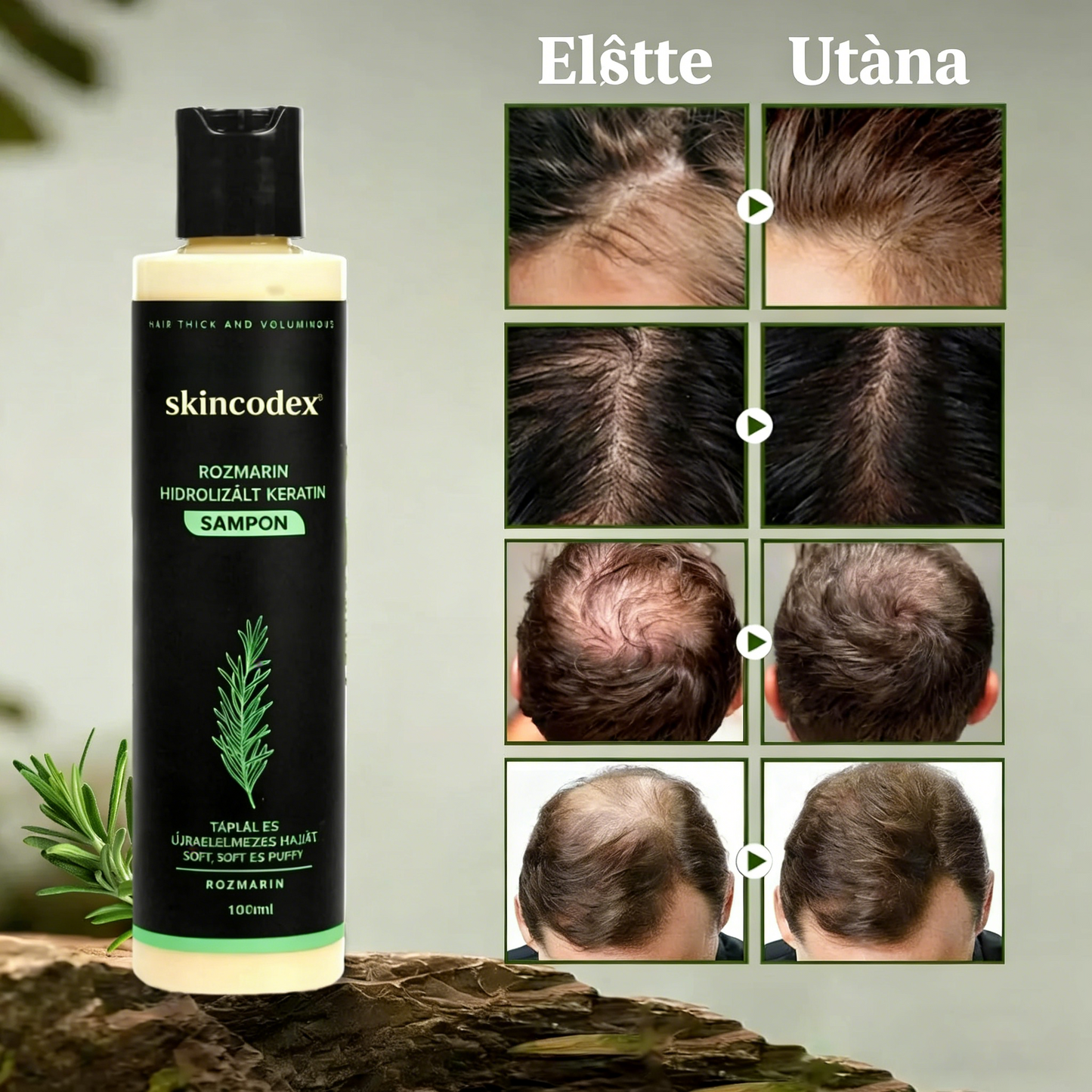 🔥UTÓS NAP 50% KEDVEZMÉNY - 🎅Skincodex® - Bio rozmaringos hajnövesztő sampon és hajbalzsam