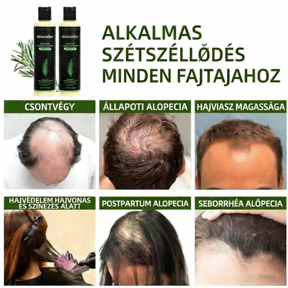 🔥UTÓS NAP 50% KEDVEZMÉNY - 🎅Skincodex® - Bio rozmaringos hajnövesztő sampon és hajbalzsam