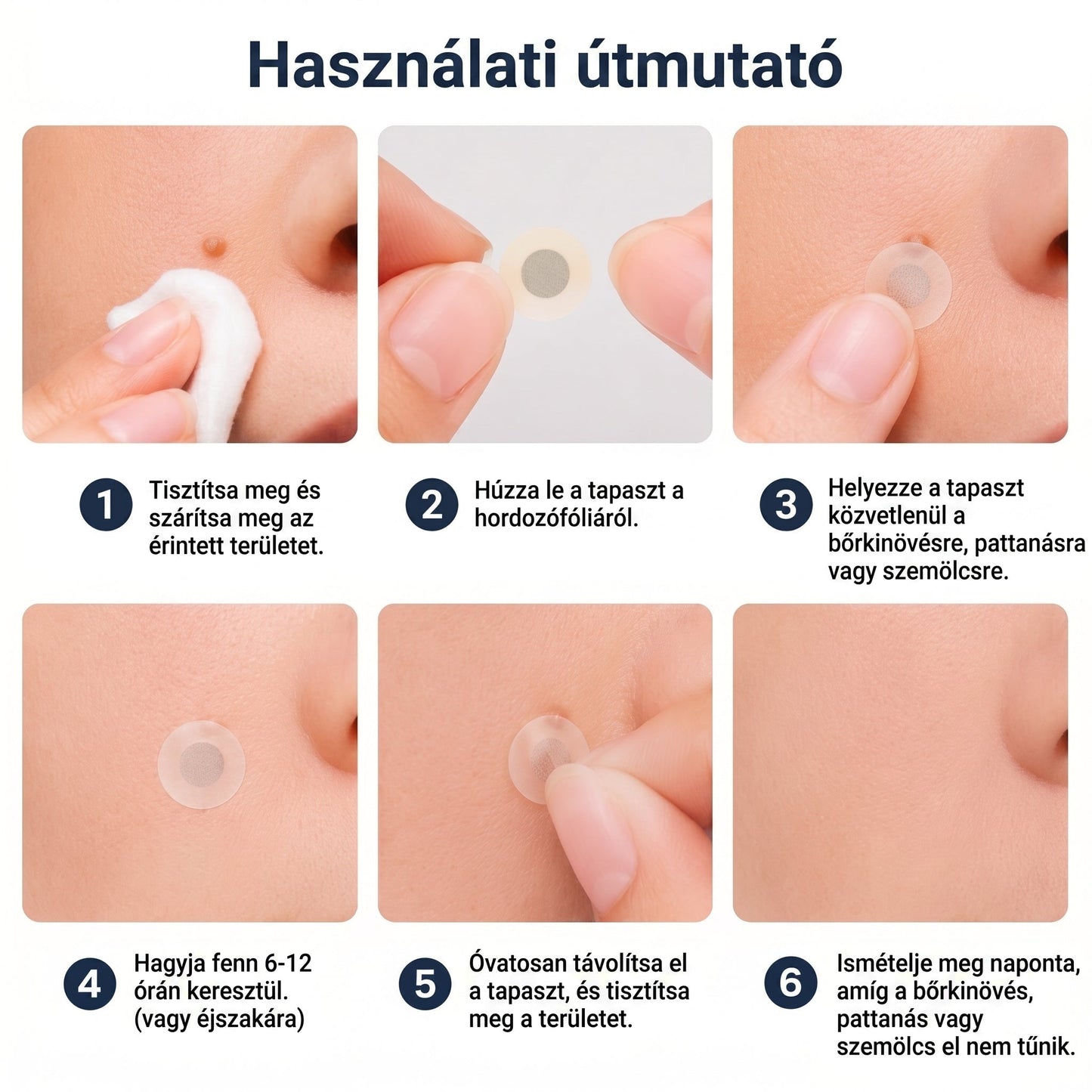 ⭐️ PuraCure® 2 az 1-ben mikrotűs és hidrokolloid tapasz🍀 | Kiálló anyajegyek, aknék, lapos szemölcsök és bőrnövedékek eltávolítására | Segít csökkenteni a ráncokat, hegeket és bőrhibákat | Láthatatlan tapasz az arcra és testre