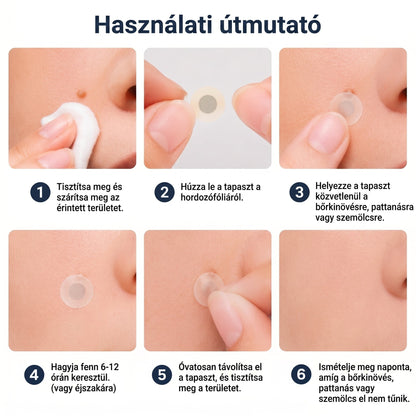 ⭐️ PuraCure® 2 az 1-ben mikrotűs és hidrokolloid tapasz🍀 | Kiálló anyajegyek, aknék, lapos szemölcsök és bőrnövedékek eltávolítására | Segít csökkenteni a ráncokat, hegeket és bőrhibákat | Láthatatlan tapasz az arcra és testre