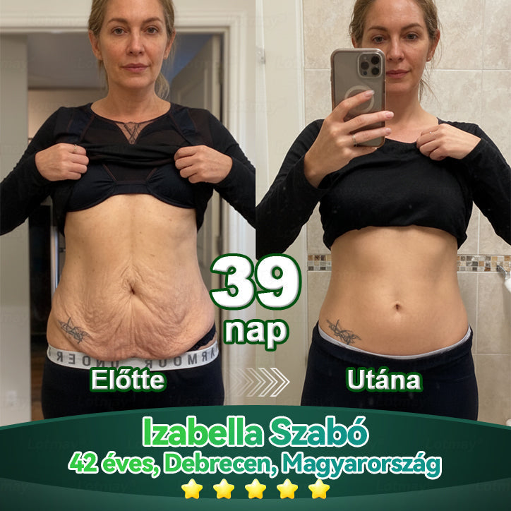 𝑳𝒐𝒕𝑚𝑎𝑦® Ő𝑠𝑠𝑒𝑗𝑡 & 𝐾𝑜𝑙𝑙𝑎𝑔é𝑛 𝑷𝒆𝒑𝒕𝒊𝒅 𝑶𝒓á𝒍𝒊𝒔 𝑪𝒔𝒆𝒑𝒑𝒆𝒌 💧(𝑭𝒆𝒔𝒛𝒆𝒔í𝒕𝒊 𝒂 𝒎𝒆𝒈𝒆𝒓𝒆𝒔𝒛𝒌𝒆𝒅𝒆𝒕𝒕 𝒃ő𝒓𝒕 & 𝑪𝒔ö𝒌𝒌𝒆𝒏𝒕𝒊 𝒂 𝒓á𝒏𝒄𝒌é𝒑𝒛ő𝒅é𝒔𝒕)🔥🔥🔥🔥🔥