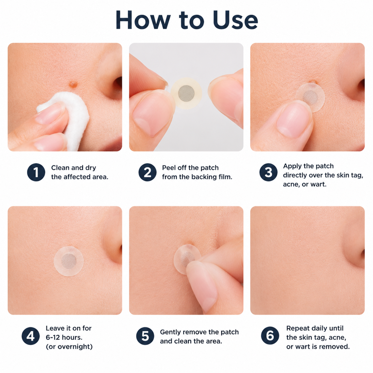 ✨Rainiste®2-in-1 Microneedle & Hydrocolloid Patch🍀| Removes Raised Moles, Acne, Flat Warts & Skin Tags | Helps Improve Wrinkles, Scars & Blemishes | Invisible Patches for Face & Body