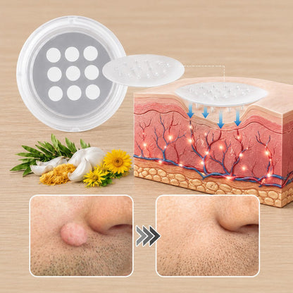 ⭐️ PuraCure® 2 az 1-ben mikrotűs és hidrokolloid tapasz🍀 | Kiálló anyajegyek, aknék, lapos szemölcsök és bőrnövedékek eltávolítására | Segít csökkenteni a ráncokat, hegeket és bőrhibákat | Láthatatlan tapasz az arcra és testre