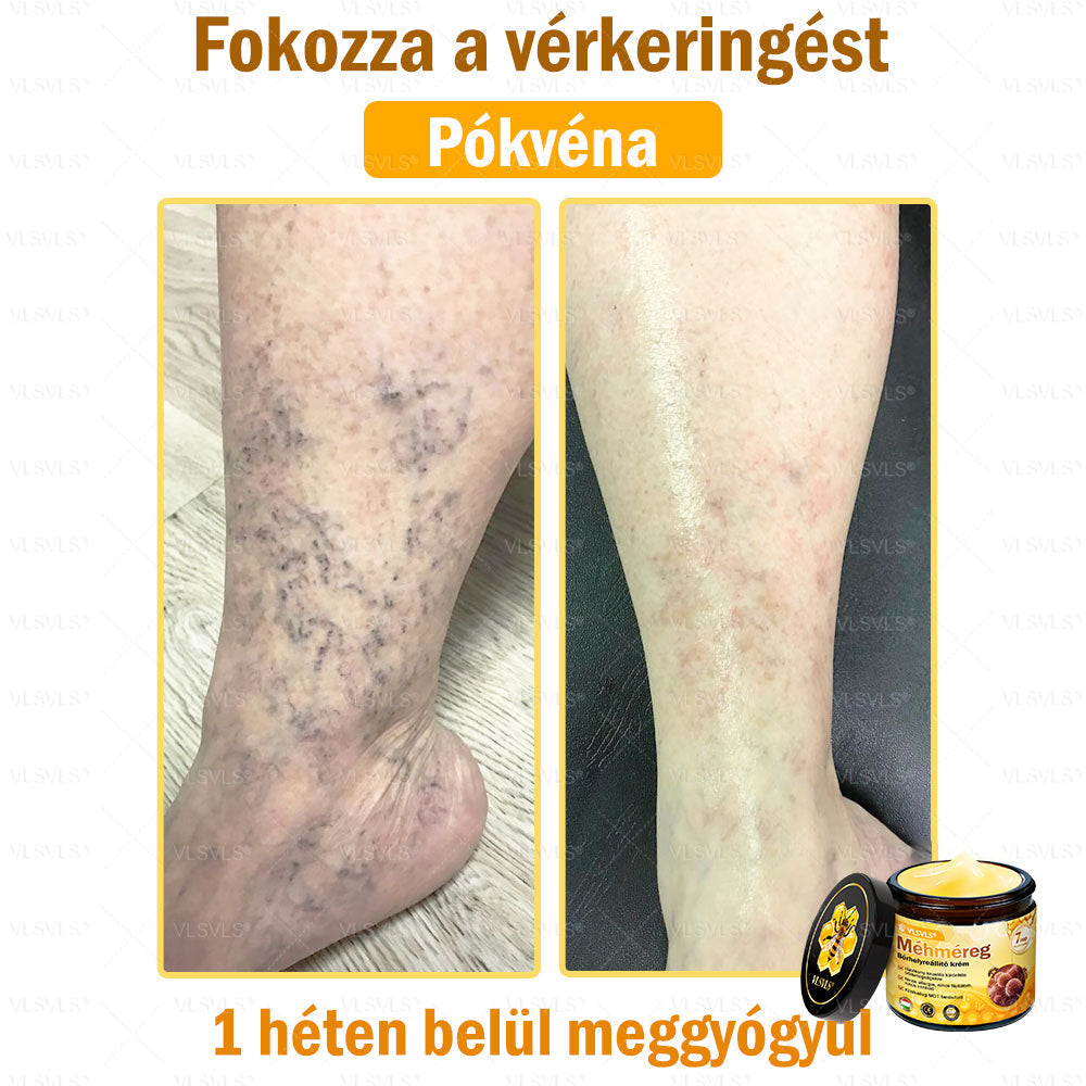 VLSVLS® Méhméreg Börhelyreállító Krém(CEjóváhagyott)