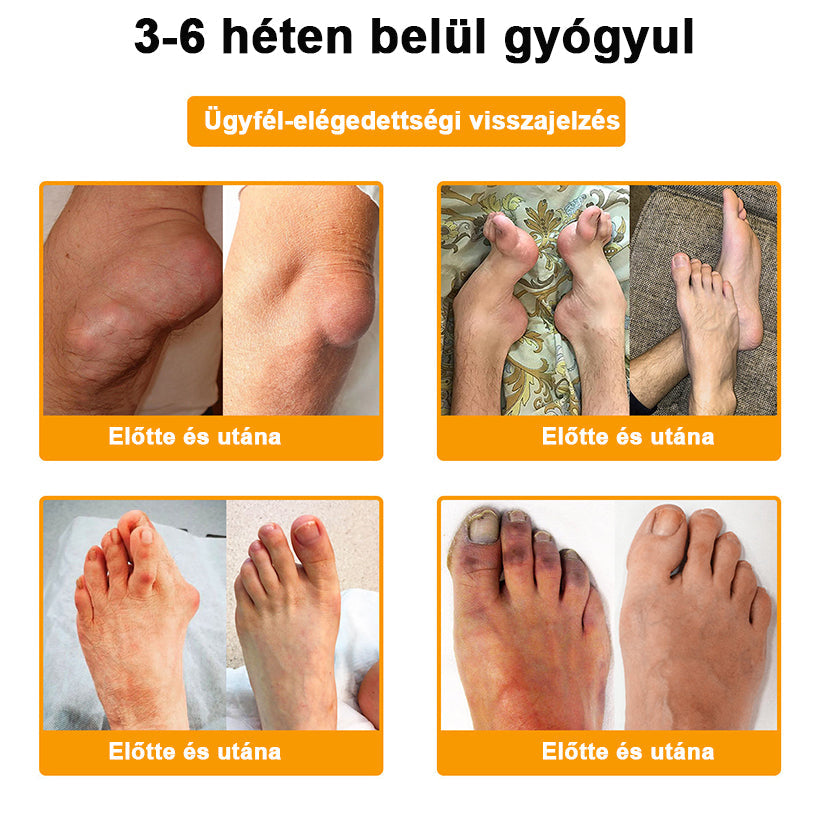 StawVital® Botoxot ésMéhmérget TartalmazóRegenerÃ¡ló KrÃém iz¼letekre ésCsontokra lMOT(MagyarOrtopéd Társaság) általtanúsitott termék