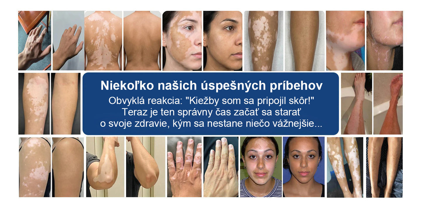 🌿🌿Laleia® Piperín Repigmentačný aktivačný sprej