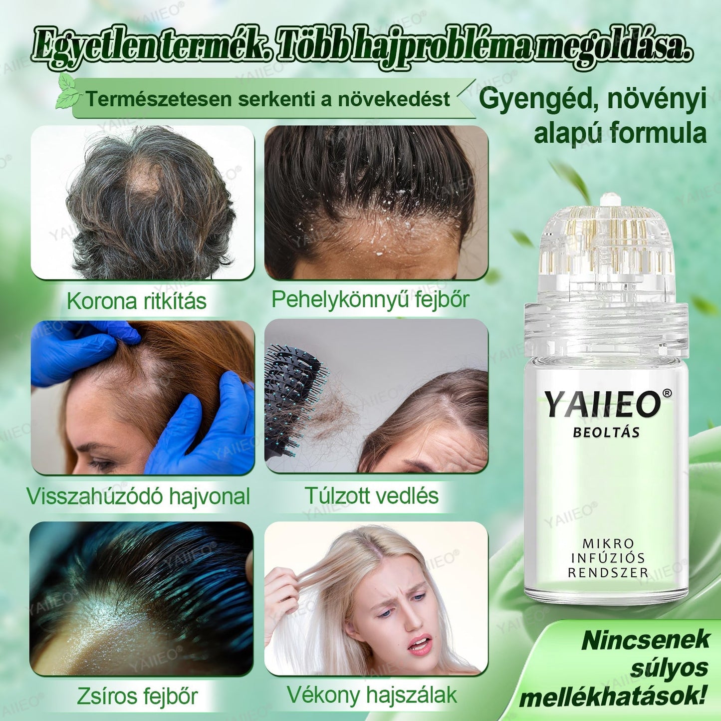 🍍𝐘𝐀𝐈𝐈𝐄𝐎® 𝑭á𝒋𝒅𝒂𝒍𝒐𝒎𝒎𝒆𝒏𝒕𝒆𝒔 𝑴𝒊𝒌𝒓𝒐𝒊𝒏𝒇ú𝒛𝒊ó𝒔 𝑹𝒆𝒏𝒅𝒔𝒛𝒆𝒓 Mélyen ható DHT-blokkolás, hajhagymák újraaktiválása és látható hajnövekedés