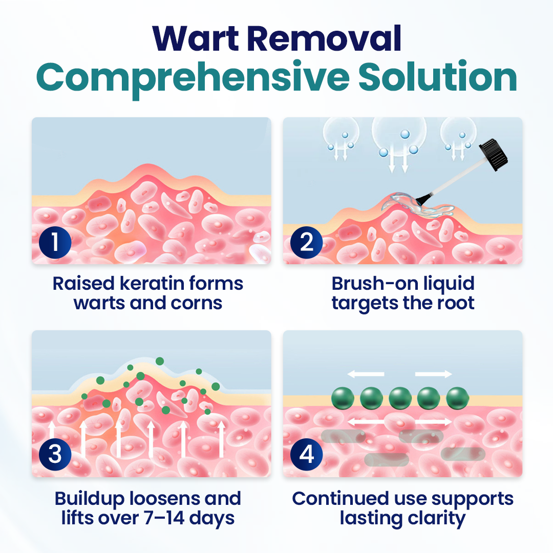 WartLift Corn Removal Liquid