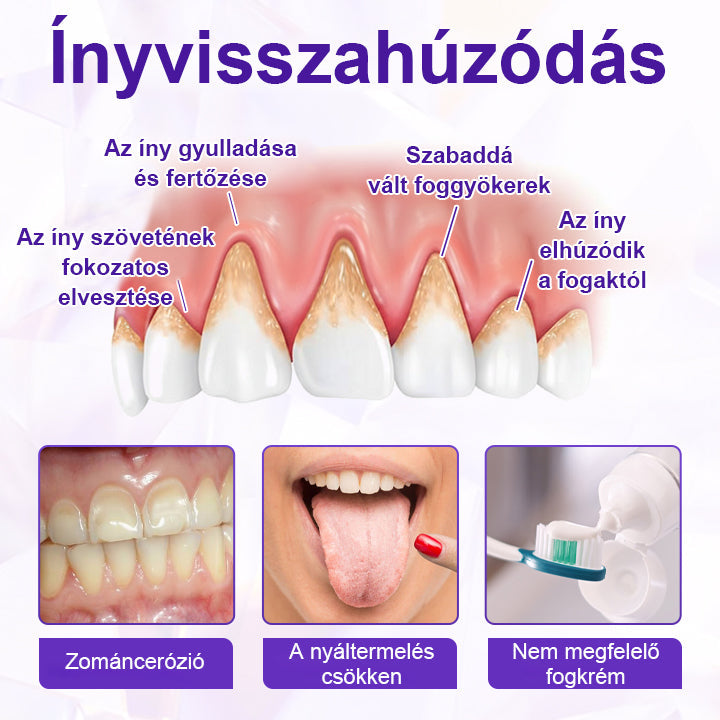 ⭐⭐Laleia® SensiGum Fluoridos Fogkrém