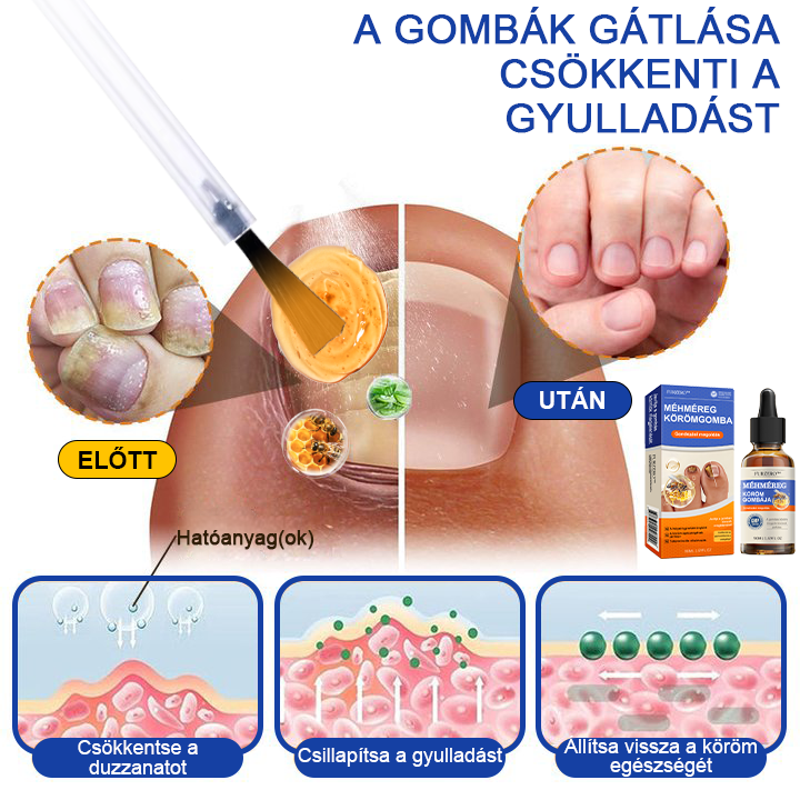🐝Furzero™ Méhméreg Körömgomba Kezelő Oldat: Teljes megoldás a körömgomba problémájára