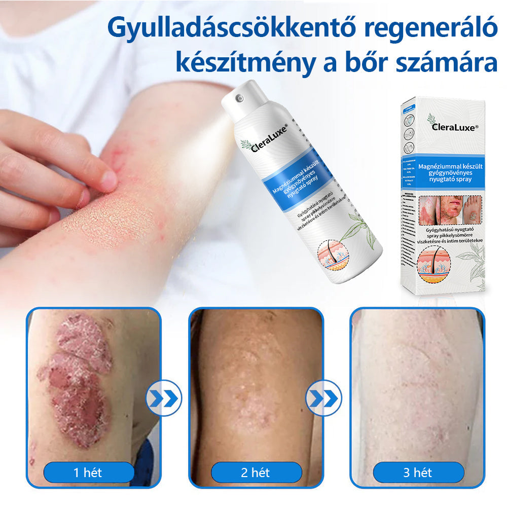CleraLuxe®  Magnézium Gyógynövényes Pszoriázis Spray📦