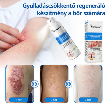 CleraLuxe®  Magnézium Gyógynövényes Pszoriázis Spray📦