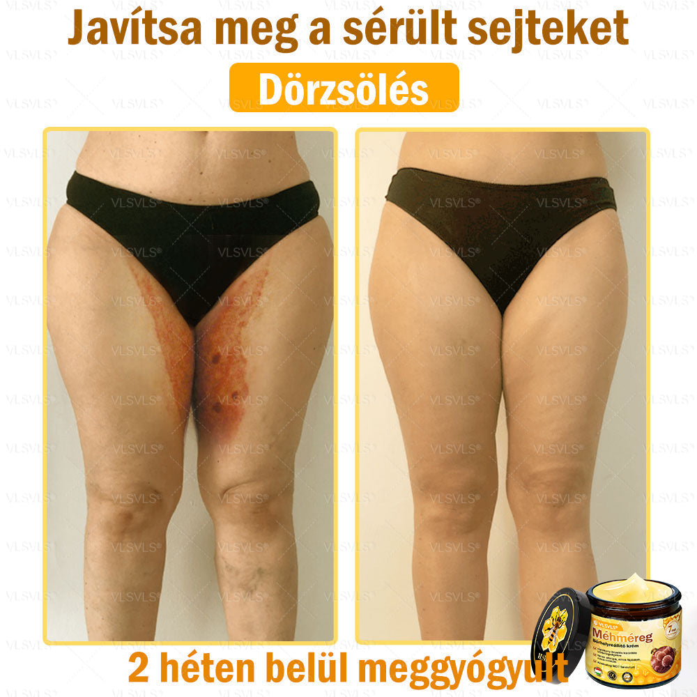 💜💜VLSVLS® Méhméreg Bőrhelyreállító Krém (👨‍⚕‍CE jóváhagyott)👍✅