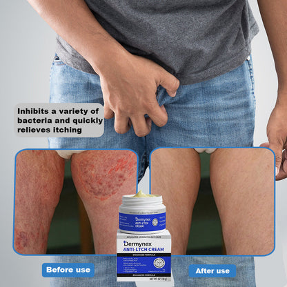 👉 Official Store: Dermynex®️ PCA-Magnesium Herbal Intimate – Multi‑Purpose Relief for Scalp Itching, Eczema, Jock Itch, Facial Acne & Fungal Infections | Herbal Extracts, Steroid‑Free, No Artificial Fragrances, Gentle for All Skin Types【Tax Free】