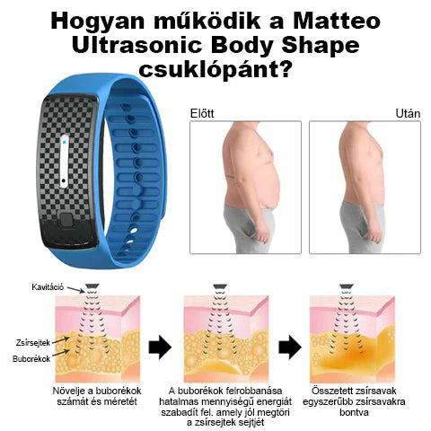 🥑 𝐉𝐎𝐒𝐅𝑰𝐓™ Ultrahangos csuklópántok a zsír eltávolítására és méregtelenítésére