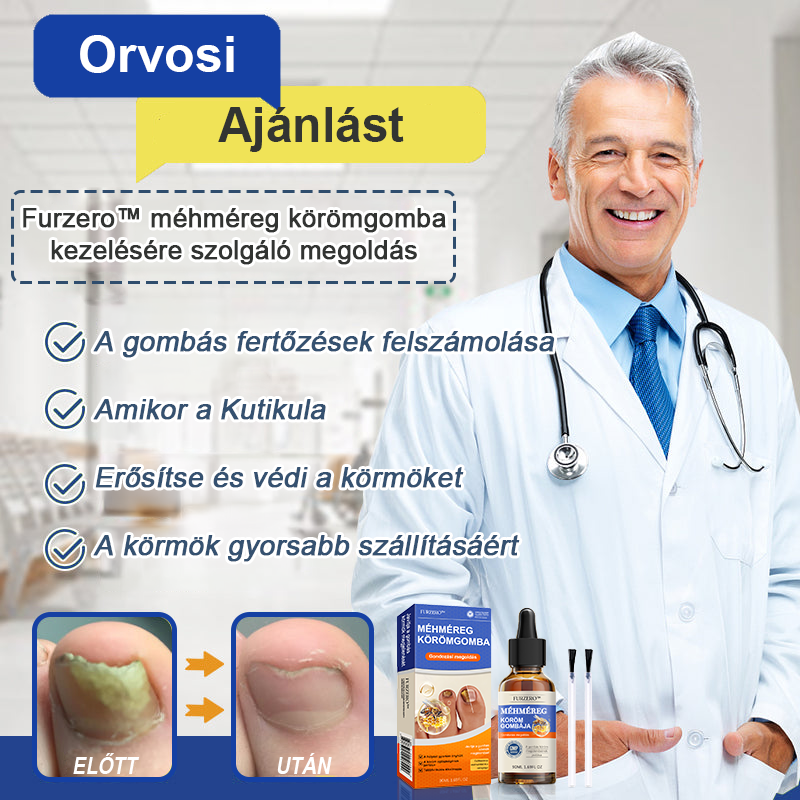 🐝Furzero™ Méhméreg Körömgomba Kezelő Oldat: Teljes megoldás a körömgomba problémájára