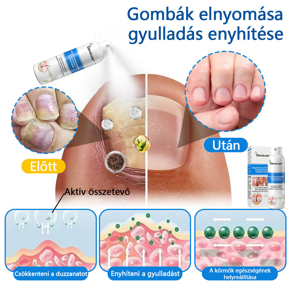 CleraLuxe®  Magnézium Gyógynövényes Pszoriázis Spray📦