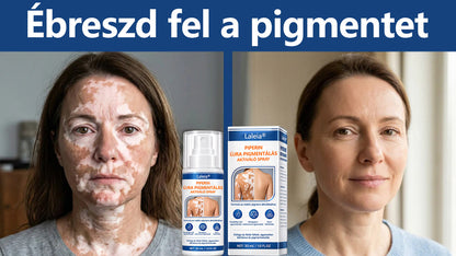 🌿Laleia® Piperine Repigment Aktivátor Spray