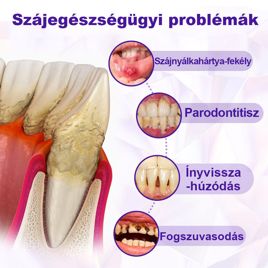 ⭐⭐Laleia® SensiGum Fluoridos Fogkrém