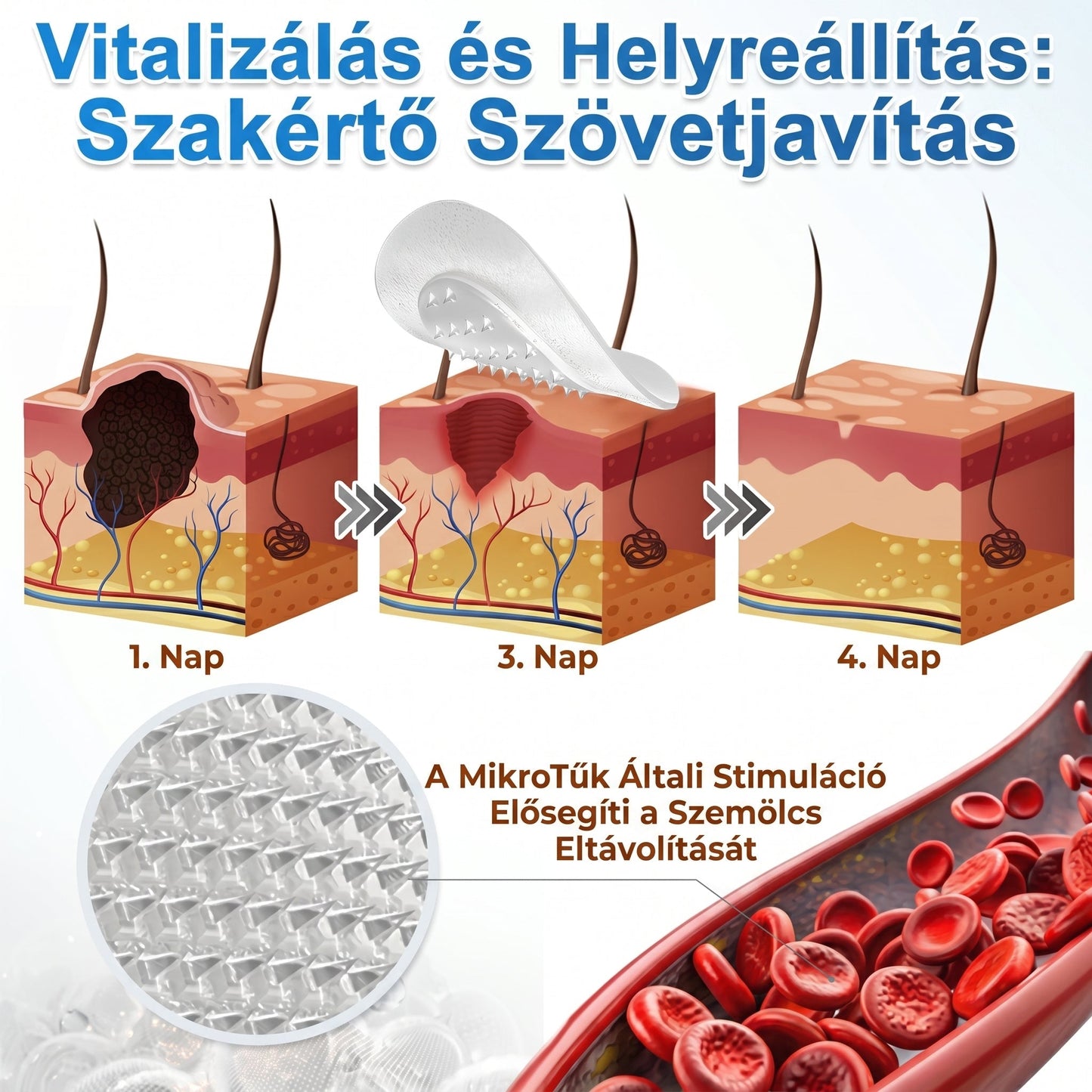 ⭐️ PuraCure® 2 az 1-ben mikrotűs és hidrokolloid tapasz🍀 | Kiálló anyajegyek, aknék, lapos szemölcsök és bőrnövedékek eltávolítására | Segít csökkenteni a ráncokat, hegeket és bőrhibákat | Láthatatlan tapasz az arcra és testre