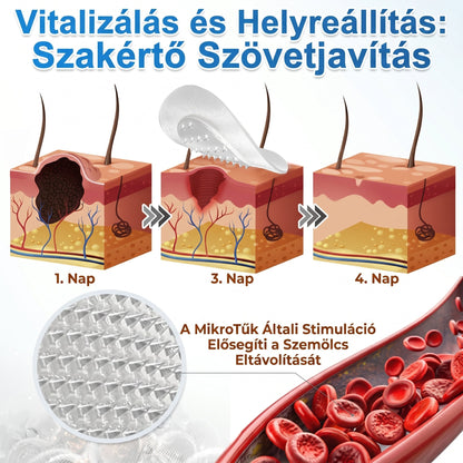 ⭐️ PuraCure® 2 az 1-ben mikrotűs és hidrokolloid tapasz🍀 | Kiálló anyajegyek, aknék, lapos szemölcsök és bőrnövedékek eltávolítására | Segít csökkenteni a ráncokat, hegeket és bőrhibákat | Láthatatlan tapasz az arcra és testre