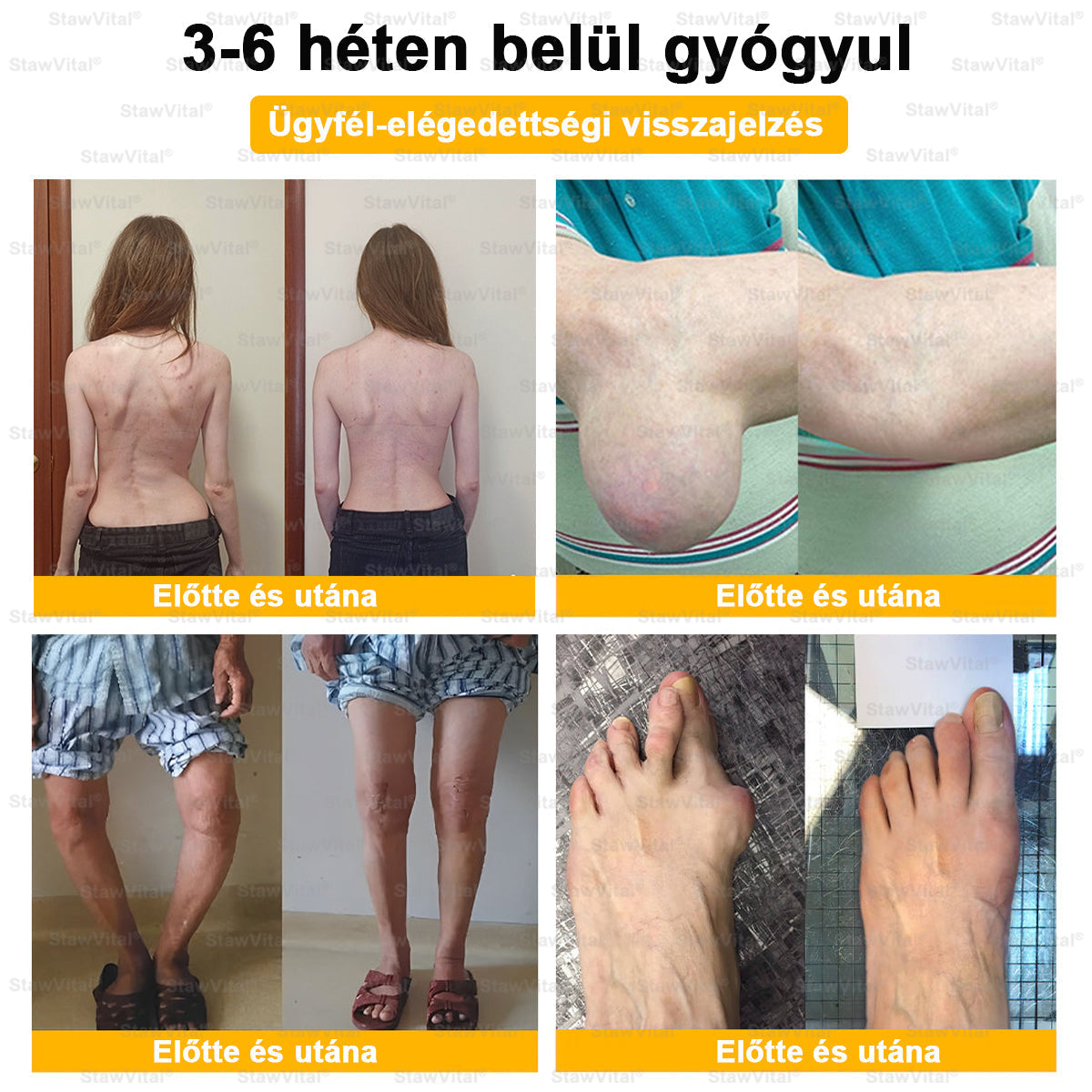 StawVital® Botoxot ésMéhmérget TartalmazóRegenerÃ¡ló KrÃém iz¼letekre ésCsontokra lMOT(MagyarOrtopéd Társaság) általtanúsitott termék
