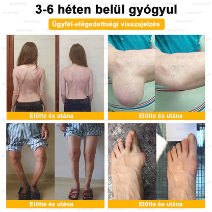 StawVital® Botoxot és Méhmérget Tartalmazó Regeneráló Krém izületekre és Csontokra – MOT (Magyar Ortopéd Társaság) által tanúsított termék