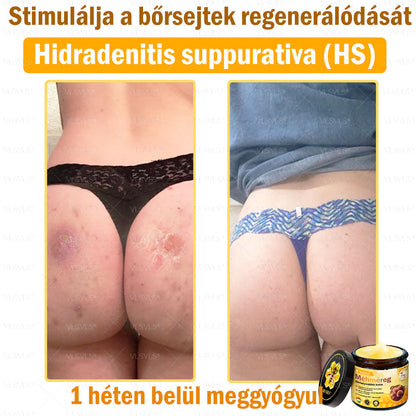 💜💜VLSVLS® Méhméreg Bőrhelyreállító Krém (👨‍⚕‍CE jóváhagyott)👍✅