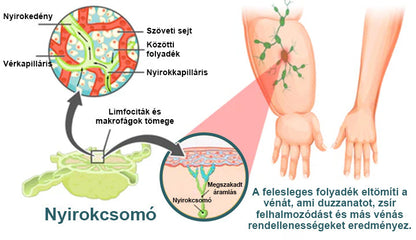 💎Laleia® Magnetológiás Moissanit Gyémánt Gyűrű