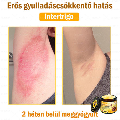 💜💜VLSVLS® Méhméreg Bőrhelyreállító Krém (👨‍⚕‍CE jóváhagyott)👍✅