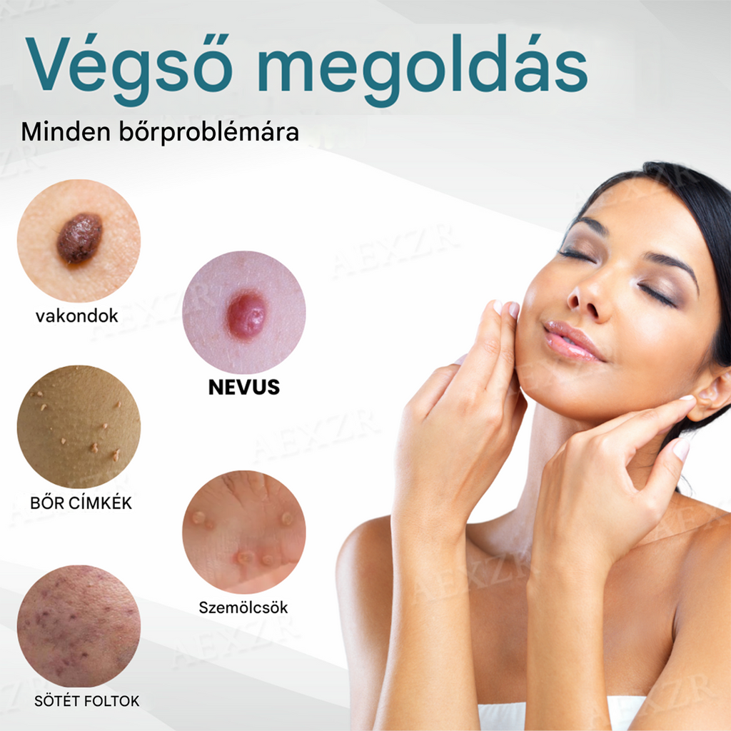 [⚡️A mai legjobb ajánlatok]🔥Bikenda® non-invazivanyajegy- ésszemölcseltávolítÃó lézertol