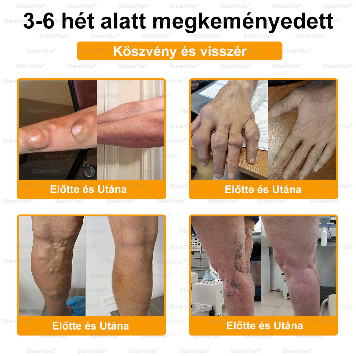 StawVital® Botoxot ésMéhmérget TartalmazóRegenerÃ¡ló KrÃém iz¼letekre ésCsontokra lMOT(MagyarOrtopéd Társaság) általtanúsitott termék