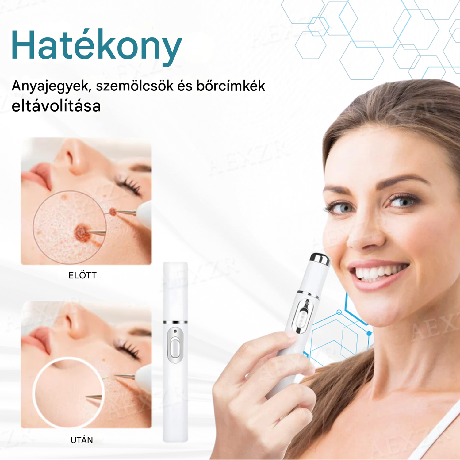 [⚡️A mai legjobb ajánlatok]🔥Bikenda® non-invazivanyajegy- ésszemölcseltávolítÃó lézertol