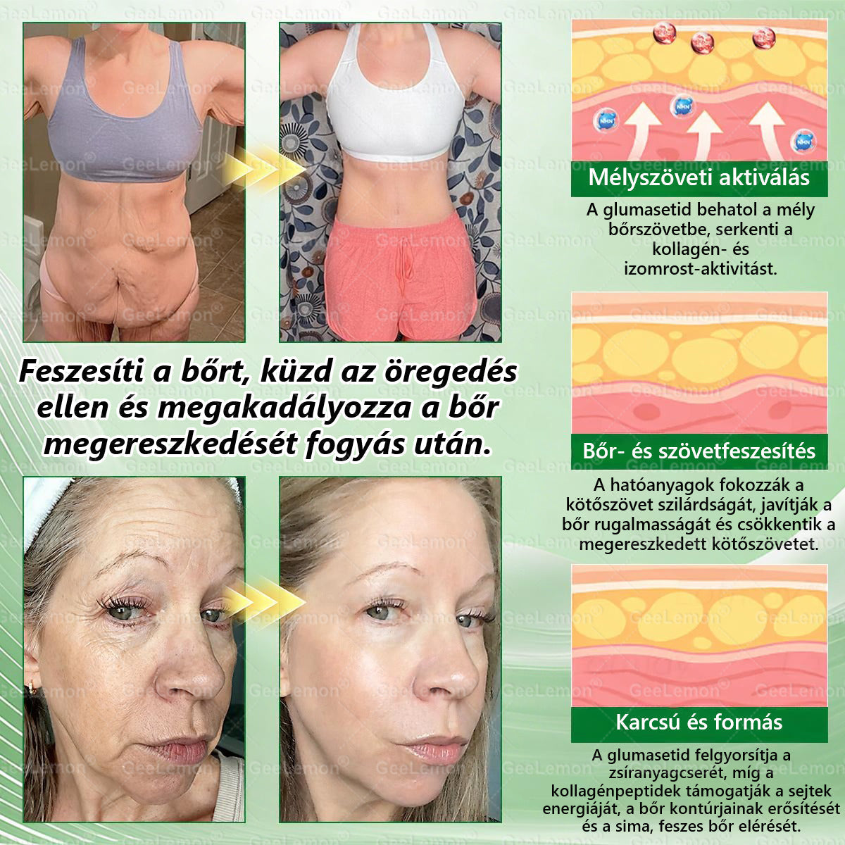 🎄🎄Ajánlott a Semmelweis Kórház által · 👩‍⚕️BENU hivatalos üzlet| 🎁 𝐆𝐞𝑒𝐿𝑒𝐦𝐨𝐧® Glumasetide 8 az 1-ben Karcsú és Egészséges Nano Mikrotűs Tapasz🍀🍀🍀🍀