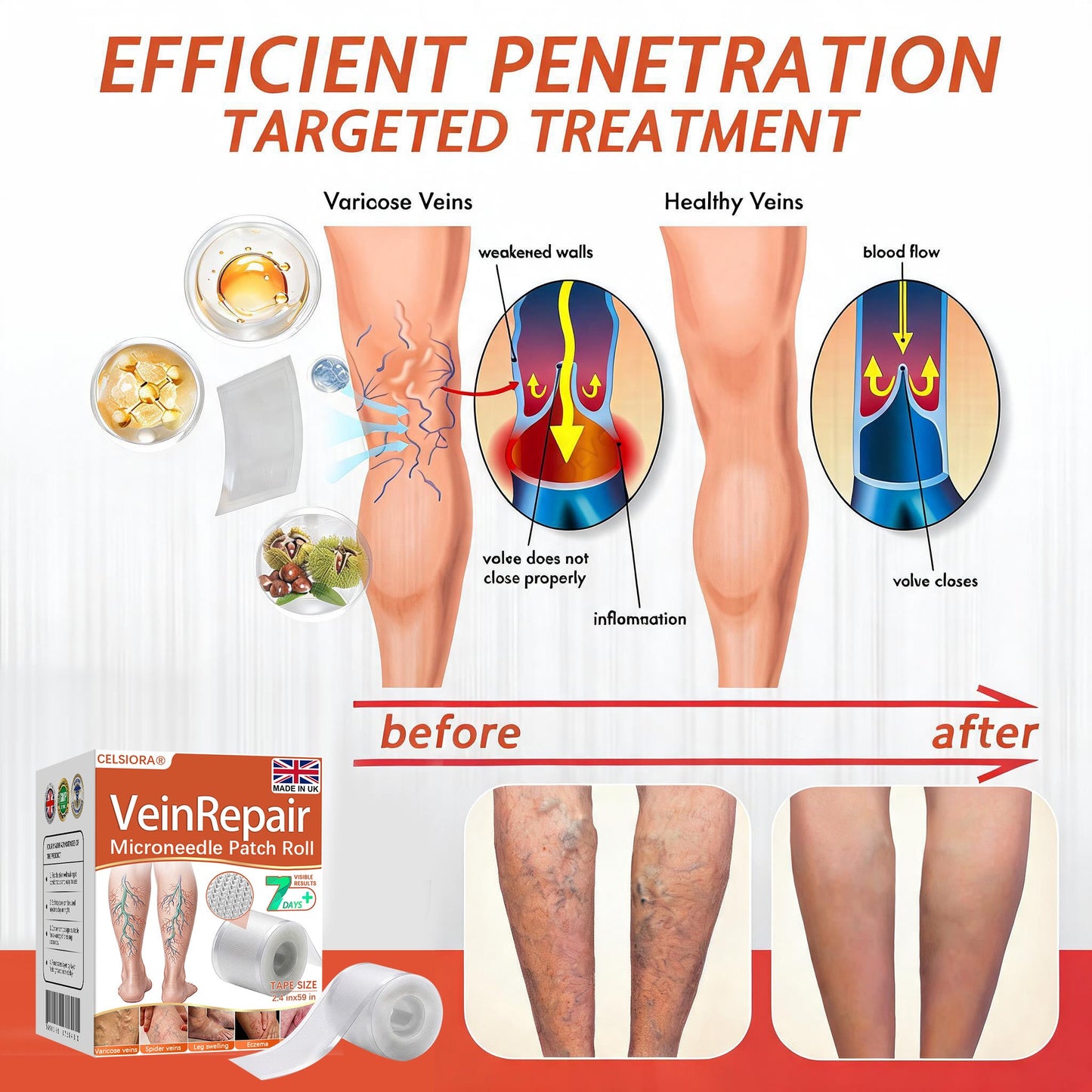 🌿❤️Celsiora® Vein Ease Microneedle Care Patch(For Spider Veins, Varicose Veins, Swelling & Leg Fatigue) - Last Day Promotion 50% OFF