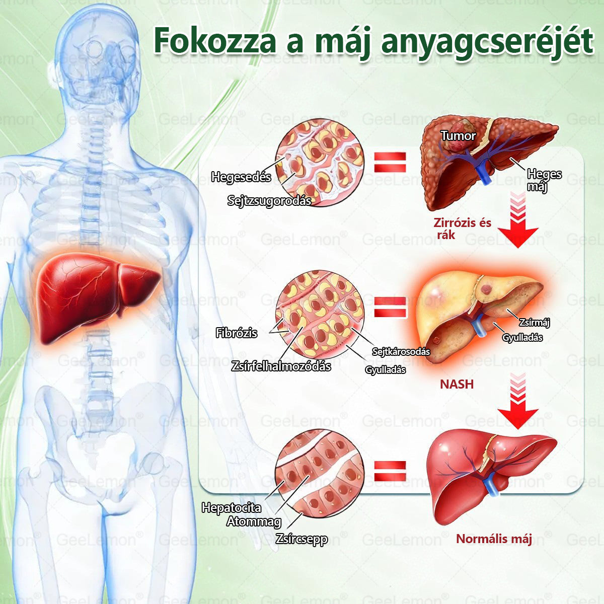 🎄🎄Ajánlott a Semmelweis Kórház által · 👩‍⚕️BENU hivatalos üzlet| 🎁 𝐆𝐞𝑒𝐿𝑒𝐦𝐨𝐧® Glumasetide 8 az 1-ben Karcsú és Egészséges Nano Mikrotűs Tapasz🍀🍀🍀🍀
