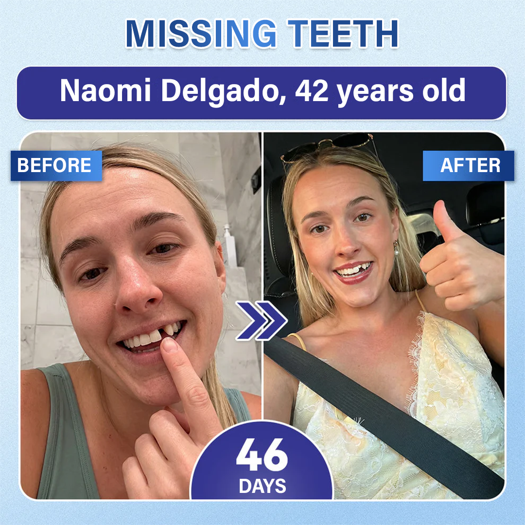 A Te Mosolyod🦷Ceoerty® Fog‑ és Ínyjavító Gyorsan Oldódó Mikrotűs Tapasz✨ (𝟓‑az‑1‑ben 💎 Zománc és Dentin Újraépítése • Ínyek Erősítése • Fogkő és Rossz Szag Megszüntetése • Fogfehérítés • Fogérzékenység Megállítása)