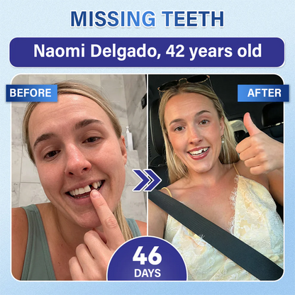 A Te Mosolyod🦷Ceoerty® Fog‑ és Ínyjavító Gyorsan Oldódó Mikrotűs Tapasz✨ (𝟓‑az‑1‑ben 💎 Zománc és Dentin Újraépítése • Ínyek Erősítése • Fogkő és Rossz Szag Megszüntetése • Fogfehérítés • Fogérzékenység Megállítása)