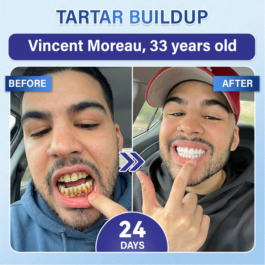 A Te Mosolyod🦷Ceoerty® Fog‑ és Ínyjavító Gyorsan Oldódó Mikrotűs Tapasz✨ (𝟓‑az‑1‑ben 💎 Zománc és Dentin Újraépítése • Ínyek Erősítése • Fogkő és Rossz Szag Megszüntetése • Fogfehérítés • Fogérzékenység Megállítása)
